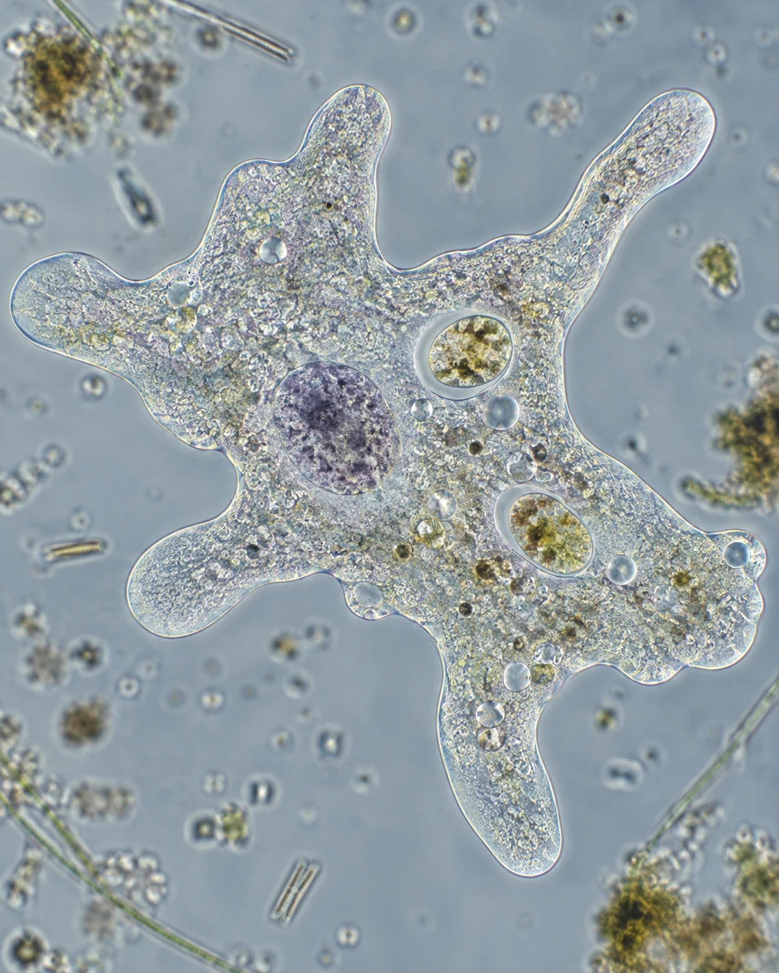 Amoeba di dalam lingkungan air